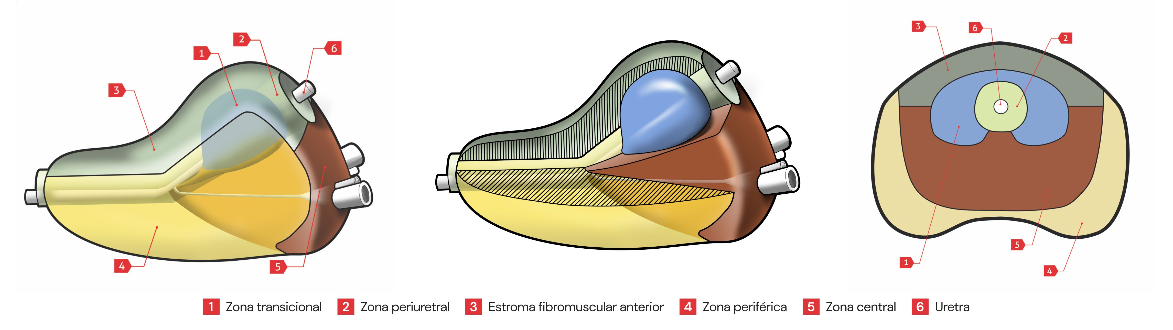 Anatomía de una próstata