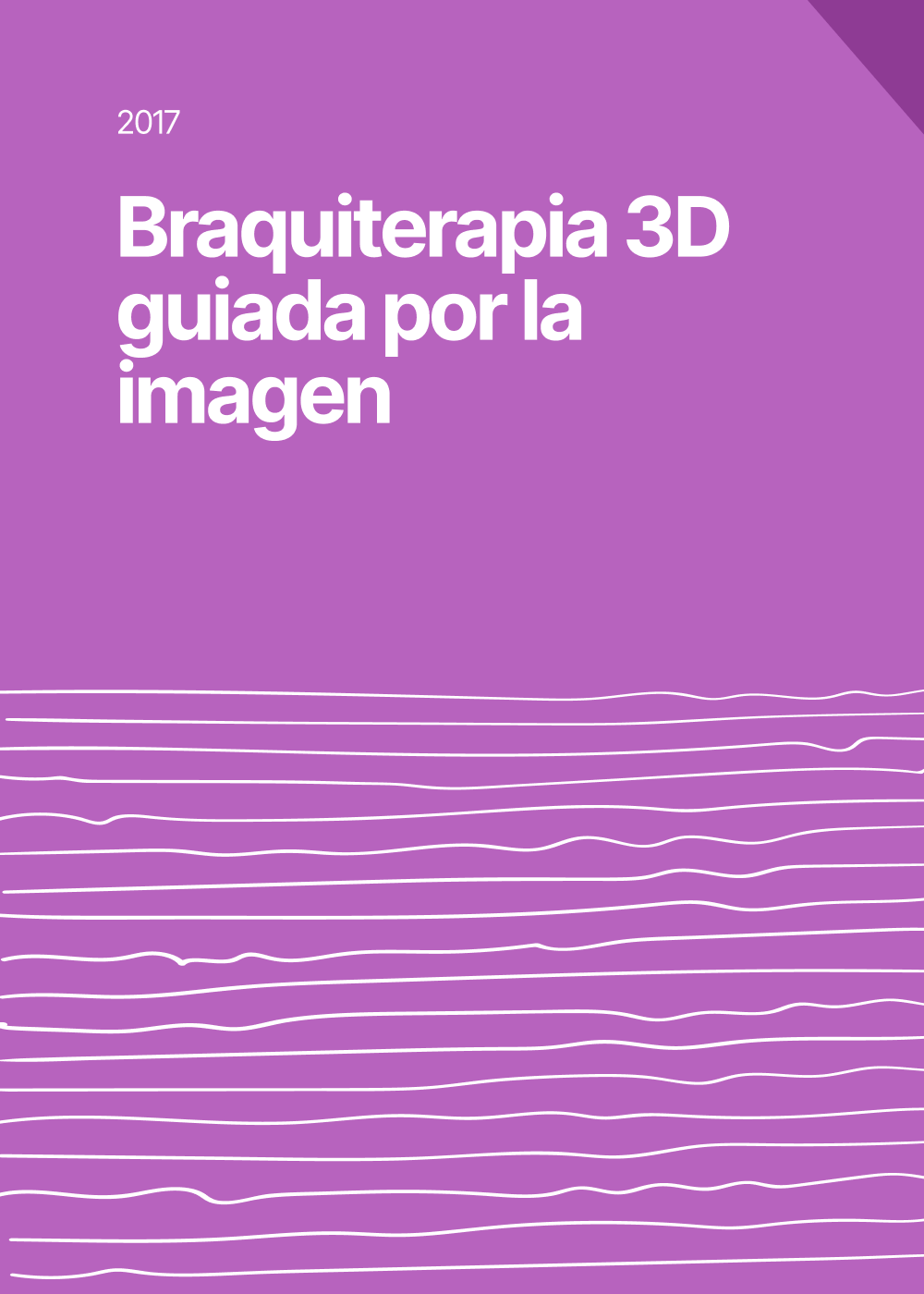 Braquiterapia 3D guiada por la imagen