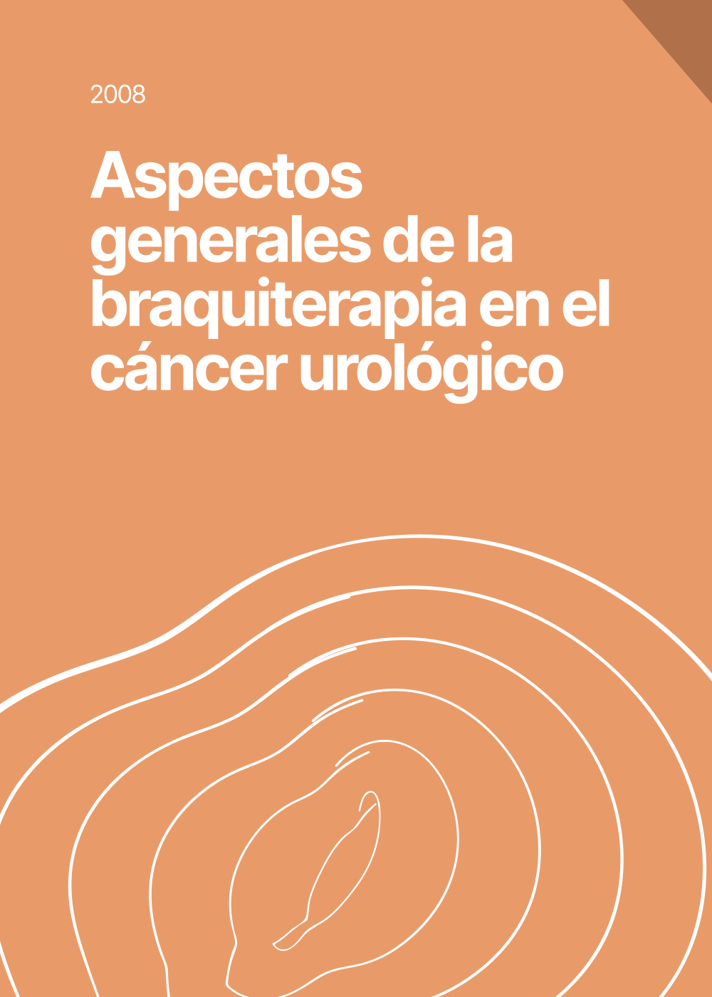 Aspectos generales de la braquiterapia en el cáncer urológico