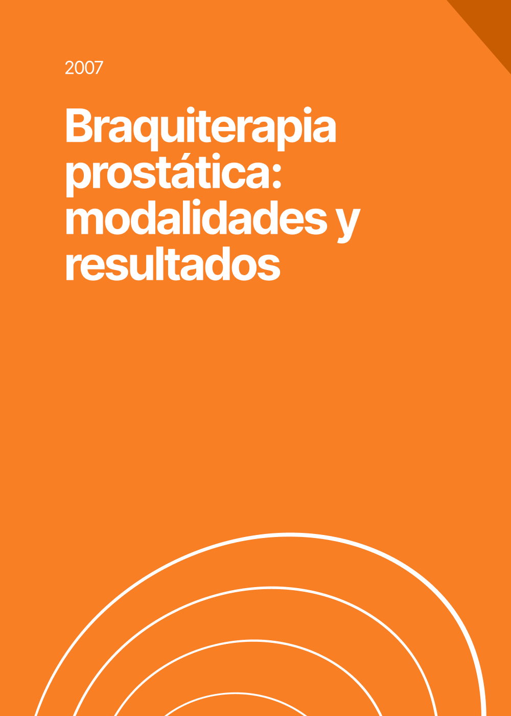 Braquiterapia prostática: modalidades y resultados