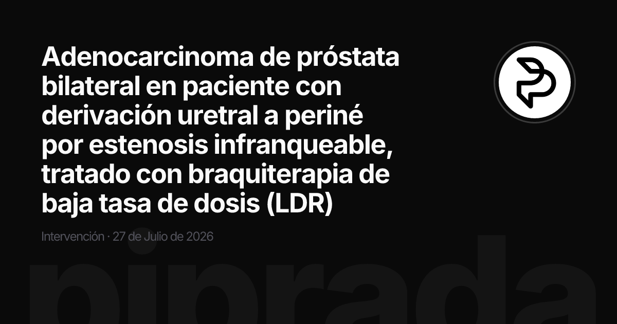 Adenocarcinoma de próstata bilateral en paciente con derivación uretral a periné por estenosis infranqueable, tratado con braquiterapia de baja tasa de dosis (LDR)